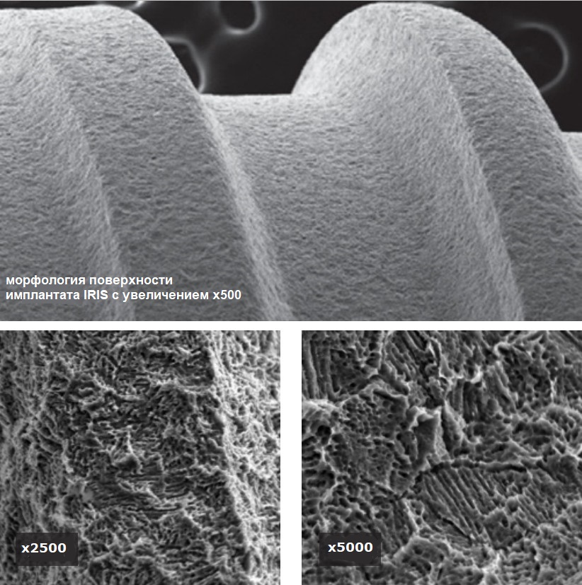 Поверхность имплантата ИРИС после обработки