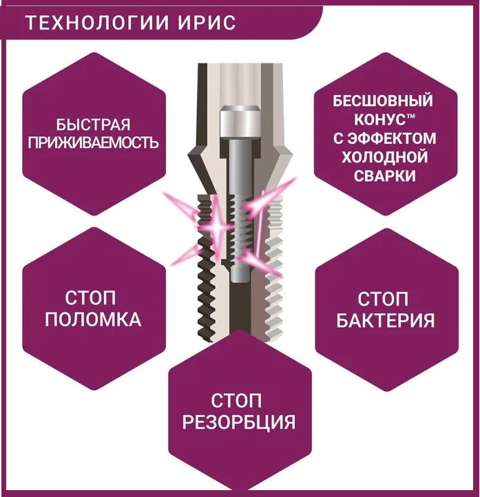 преимущества системы ИРИС преимущества системы ИРИС